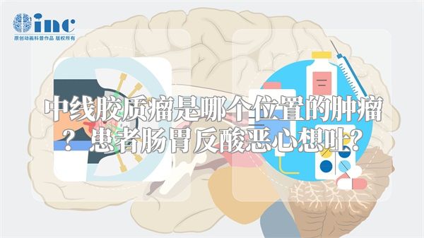 中线胶质瘤是哪个位置的肿瘤？患者肠胃反酸恶心想吐？