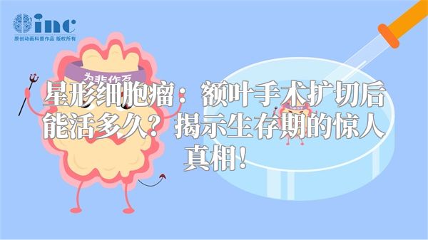 星形细胞瘤：额叶手术扩切后能活多久？揭示生存期的惊人真相！