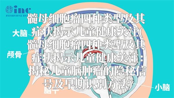髓母细胞瘤四种类型及其症状揭示儿童健康关注(髓母细胞瘤四种类型及其症状揭示儿童健康关注：揭秘儿童脑肿瘤的隐秘信号及早期识别方法)