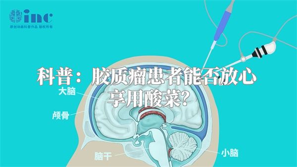 科普：胶质瘤患者能否放心享用酸菜？