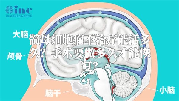髓母细胞瘤不治疗能活多久？手术要做多久才能恢复？