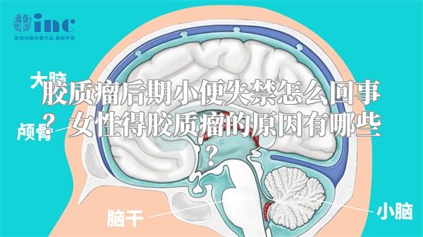 胶质瘤后期小便失禁怎么回事？女性得胶质瘤的原因有哪些？