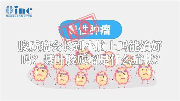 胶质瘤会长到小脑上吗能治好吗？聂叶胶质瘤是什么症状？