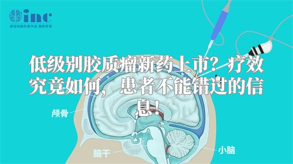 低级别胶质瘤新药上市？疗效究竟如何，患者不能错过的信息！