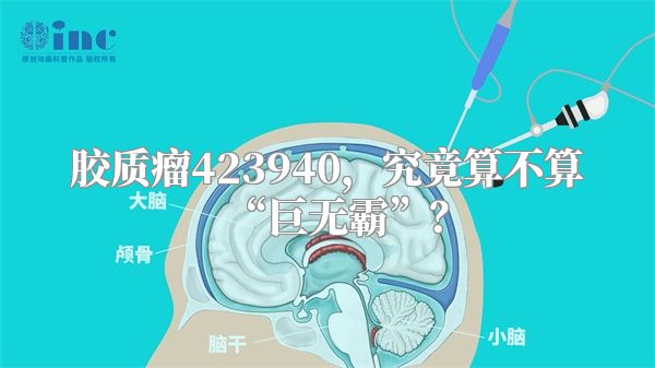 胶质瘤423940，究竟算不算“巨无霸”？