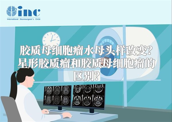 胶质母细胞瘤水母头样改变？星形胶质瘤和胶质母细胞瘤的区别？