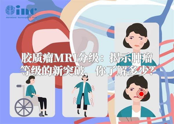 胶质瘤MRI分级：揭示肿瘤等级的新突破，你了解多少？