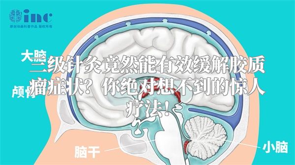 三级针灸竟然能有效缓解胶质瘤症状？你绝对想不到的惊人疗法！