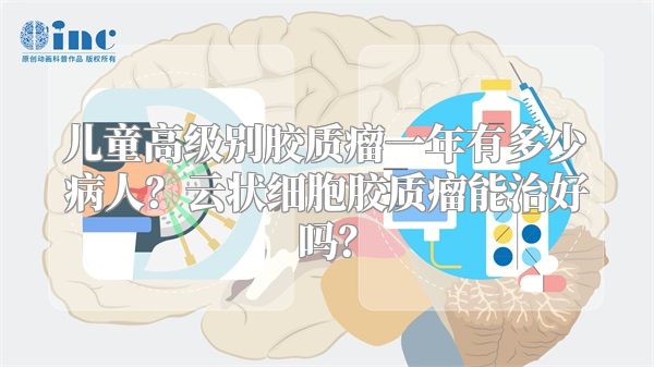 儿童高级别胶质瘤一年有多少病人？云状细胞胶质瘤能治好吗？