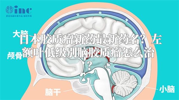 日本胶质瘤新药最新药名？左额叶低级别脑胶质瘤怎么治？