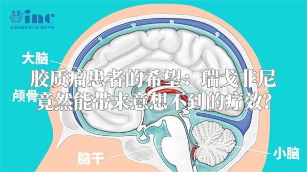 胶质瘤患者的希望：瑞戈非尼竟然能带来意想不到的疗效？