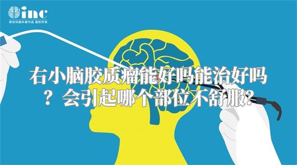 右小脑胶质瘤能好吗能治好吗？会引起哪个部位不舒服？