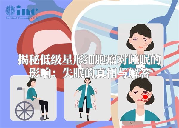 揭秘低级星形细胞瘤对睡眠的影响：失眠的真相与解答