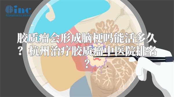 胶质瘤会形成脑梗吗能活多久？杭州治疗胶质瘤中医院排名？