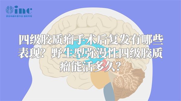 四级胶质瘤手术后复发有哪些表现？野生型弥漫性四级胶质瘤能活多久？