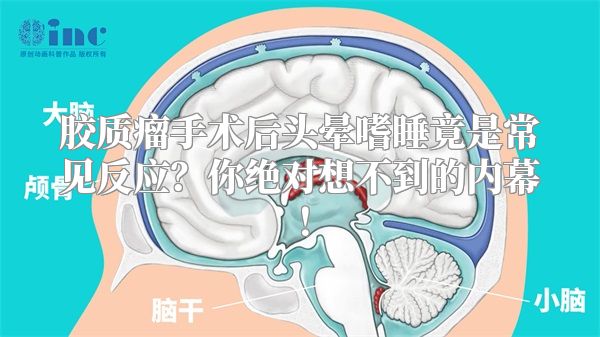 胶质瘤手术后头晕嗜睡竟是常见反应？你绝对想不到的内幕！