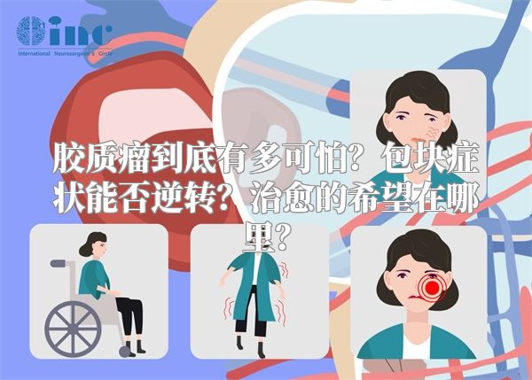 胶质瘤到底有多可怕？包块症状能否逆转？治愈的希望在哪里？