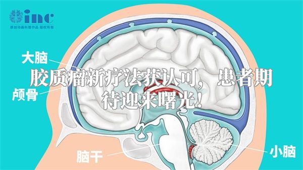 胶质瘤新疗法获认可，患者期待迎来曙光！
