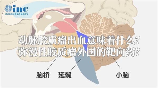 动脉胶质瘤出血意味着什么？弥漫性胶质瘤外国的靶向药？