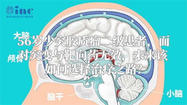 56岁少突胶质瘤二级患者，面对突变与靶向药无效，未来该如何选择治疗之路？