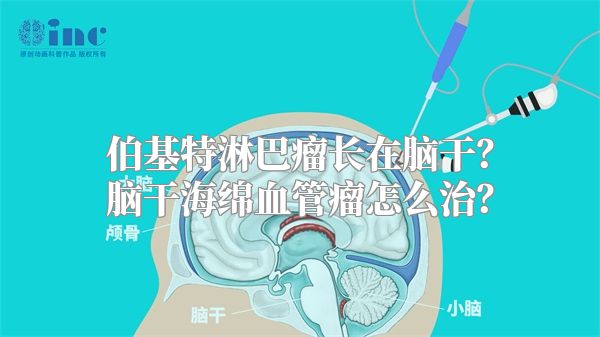 伯基特淋巴瘤长在脑干？脑干海绵血管瘤怎么治？