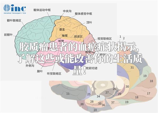 胶质瘤患者的血瘀症状揭示，了解这些或能改善你的生活质量！
