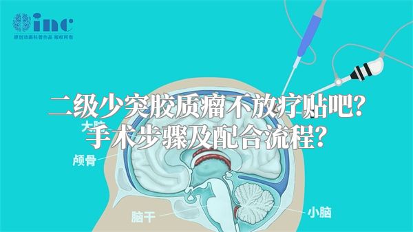 二级少突胶质瘤不放疗贴吧？手术步骤及配合流程？