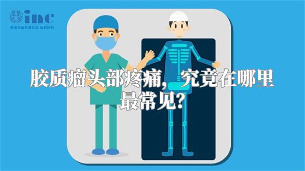 胶质瘤头部疼痛，究竟在哪里最常见？