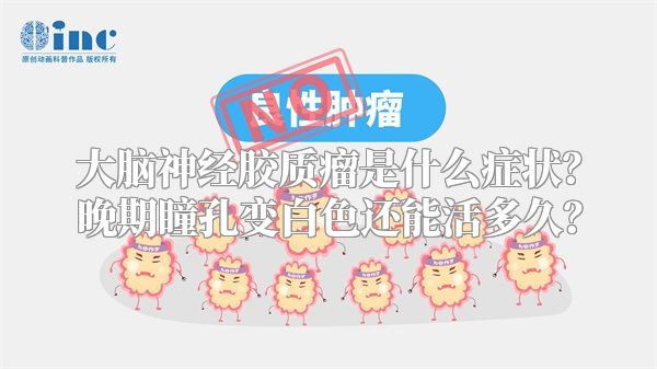 大脑神经胶质瘤是什么症状？晚期瞳孔变白色还能活多久？