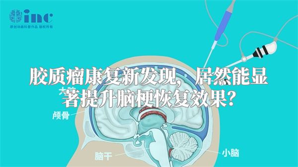 胶质瘤康复新发现，居然能显著提升脑梗恢复效果？
