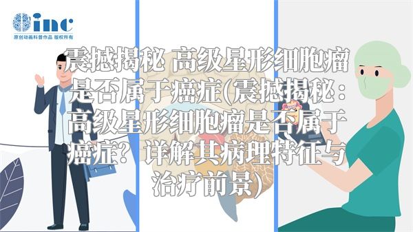 震撼揭秘 高级星形细胞瘤是否属于癌症(震撼揭秘：高级星形细胞瘤是否属于癌症？详解其病理特征与治疗前景)
