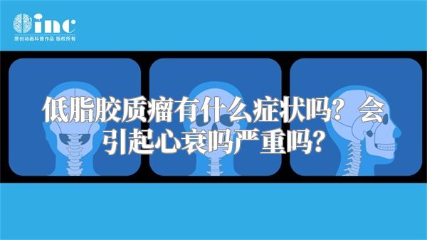 低脂胶质瘤有什么症状吗？会引起心衰吗严重吗？