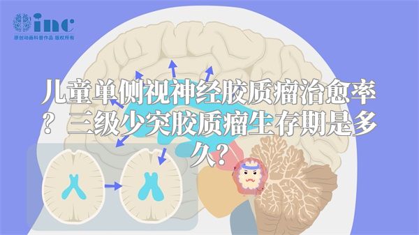 儿童单侧视神经胶质瘤治愈率？三级少突胶质瘤生存期是多久？