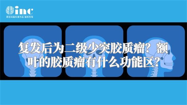 复发后为二级少突胶质瘤？额叶的胶质瘤有什么功能区？