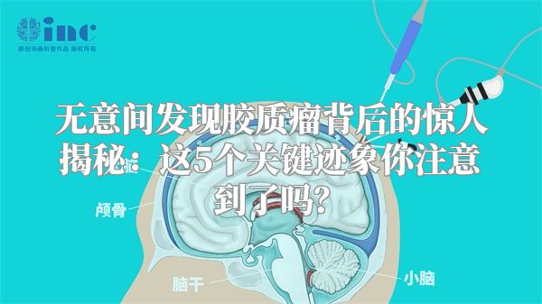 无意间发现胶质瘤背后的惊人揭秘：这5个关键迹象你注意到了吗？