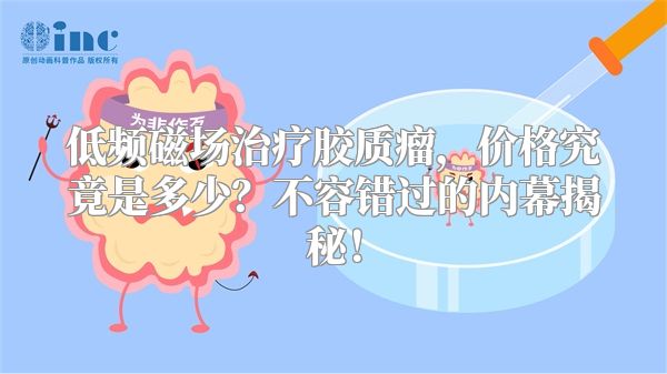 低频磁场治疗胶质瘤，价格究竟是多少？不容错过的内幕揭秘！