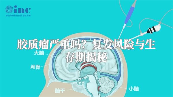 胶质瘤严重吗？复发风险与生存期揭秘