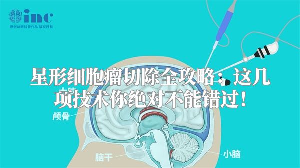 星形细胞瘤切除全攻略：这几项技术你绝对不能错过！