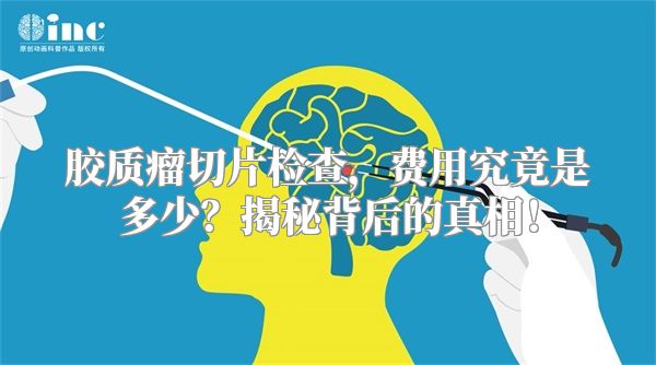 胶质瘤切片检查，费用究竟是多少？揭秘背后的真相！