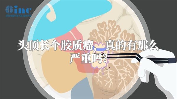头顶长个胶质瘤，真的有那么严重吗？