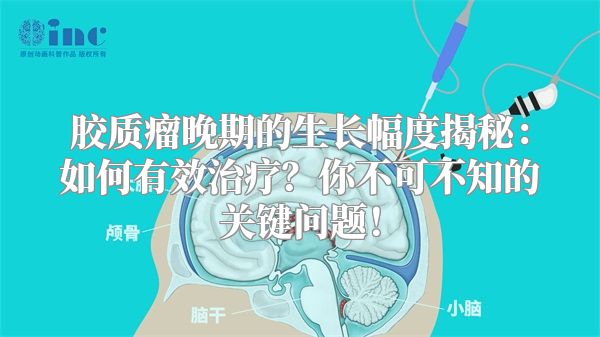 胶质瘤晚期的生长幅度揭秘：如何有效治疗？你不可不知的关键问题！
