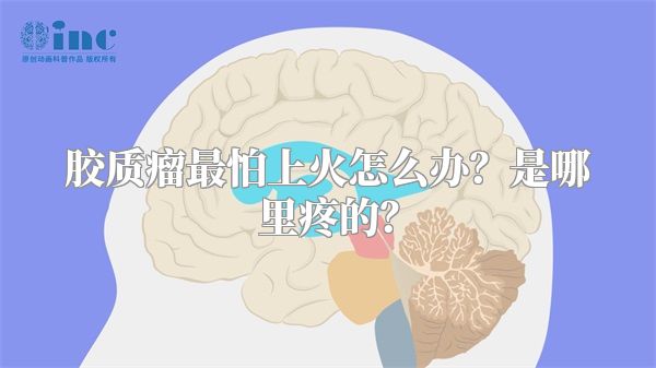 胶质瘤最怕上火怎么办？是哪里疼的？