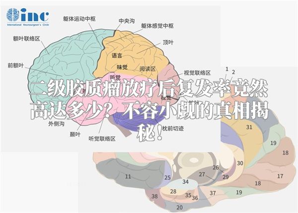 二级胶质瘤放疗后复发率竟然高达多少？不容小觑的真相揭秘！