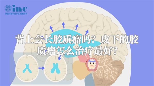 背上会长胶质瘤吗？皮下的胶质瘤怎么治疗最好？