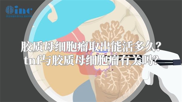 胶质母细胞瘤取出能活多久？tnf与胶质母细胞瘤有关吗？