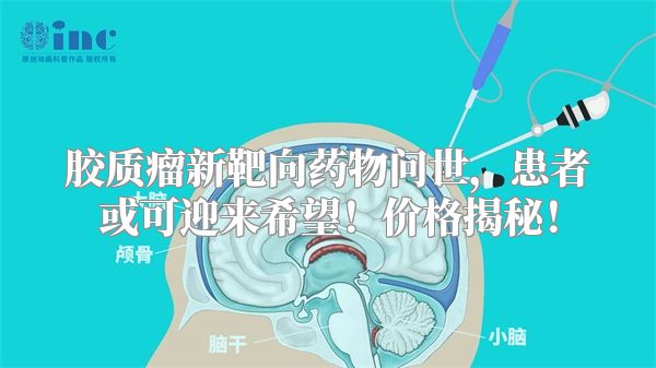 胶质瘤新靶向药物问世，患者或可迎来希望！价格揭秘！