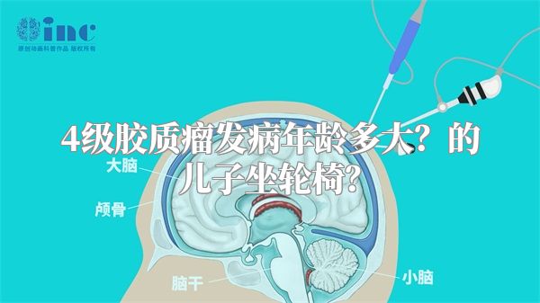 4级胶质瘤发病年龄多大？的儿子坐轮椅？