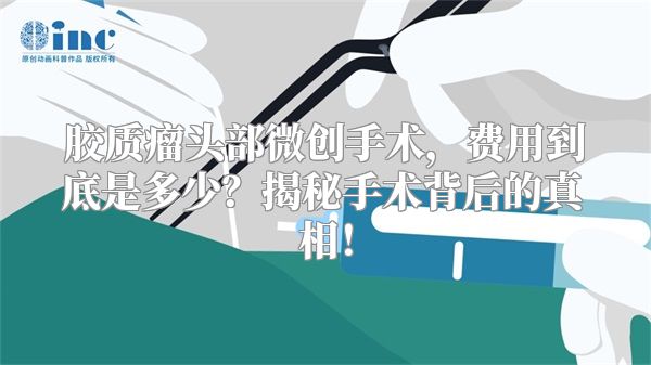 胶质瘤头部微创手术，费用到底是多少？揭秘手术背后的真相！