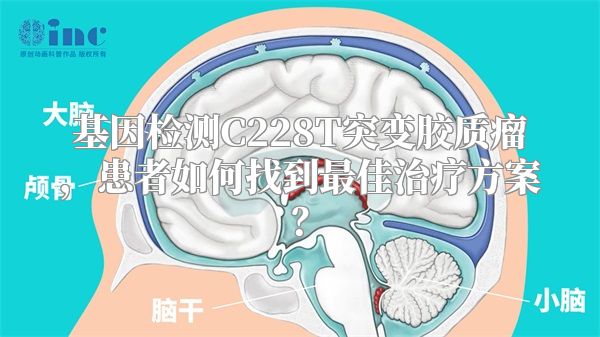 基因检测C228T突变胶质瘤，患者如何找到最佳治疗方案？
