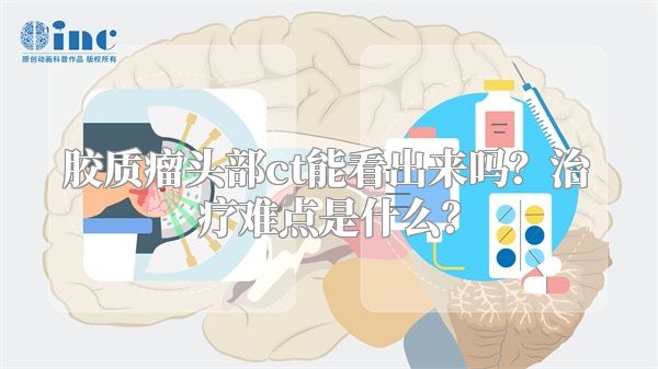 胶质瘤头部ct能看出来吗？治疗难点是什么？